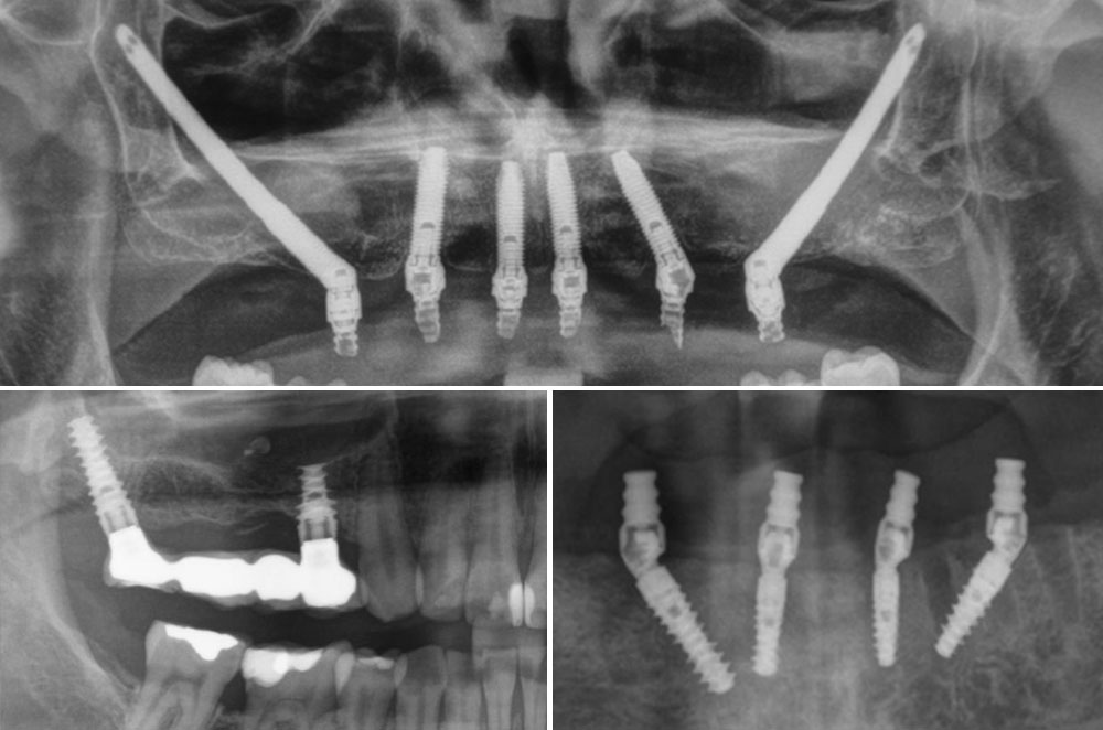 Cirugía Maxilofacial Nonium