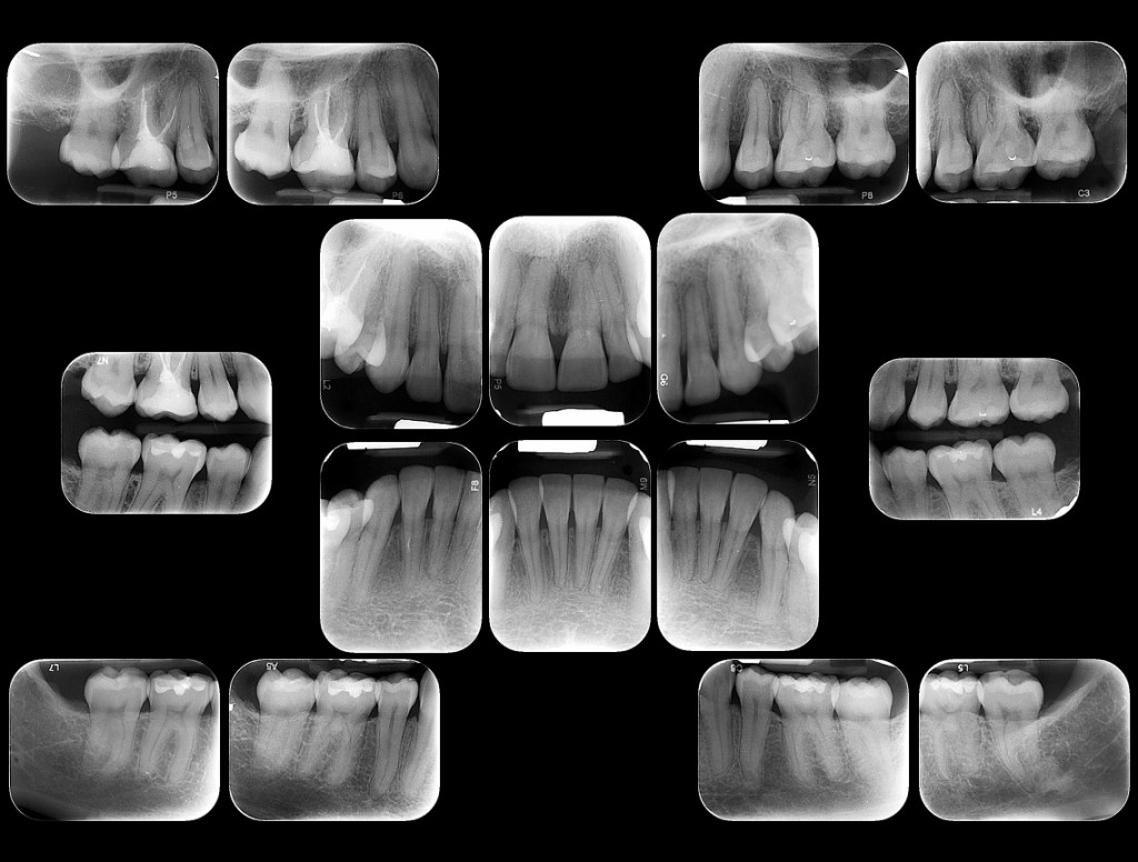 Periodoncia - Serie Periapical